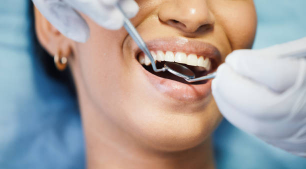 Best Urgent Care for Lost Fillings or Crowns in Estill Springs, TN