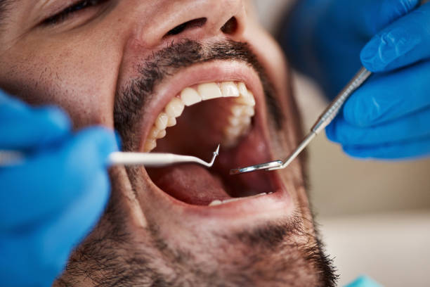 Best Emergency Treatment for Dental Infections or Abscesses in Estill Springs, TN